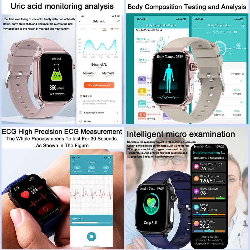 2025 Neu Für XIAOM1 EKG+PPG Bl – Smartwatch New Watches 2025 Bewertung und Preis