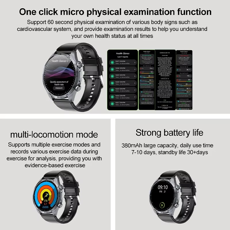 2026 Neue EKG+PPG-Monitor Smar – Smartwatch New Watches 2025 Bewertung und Preis
